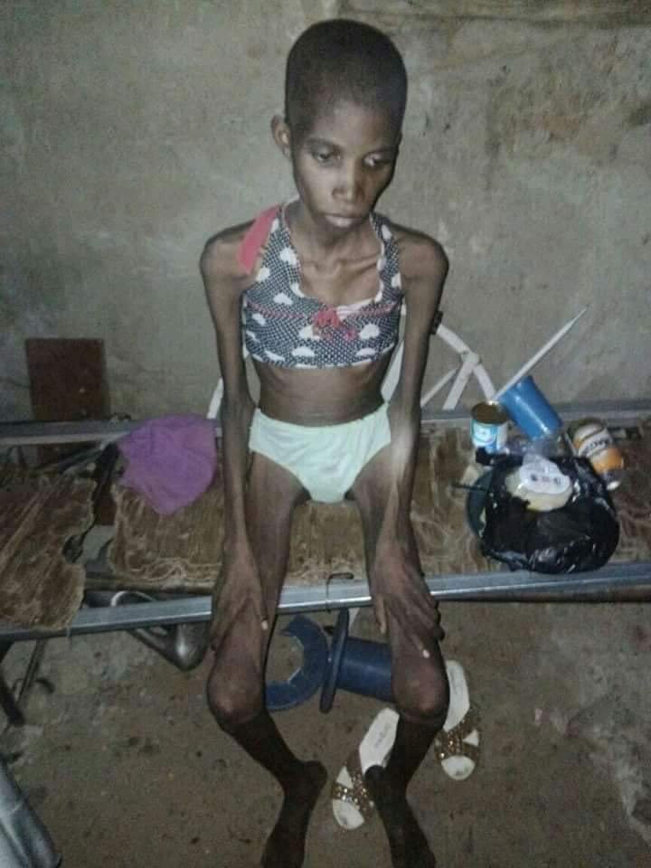 Sokoto police rescue 12-year-old girl caged and starved for 8 months