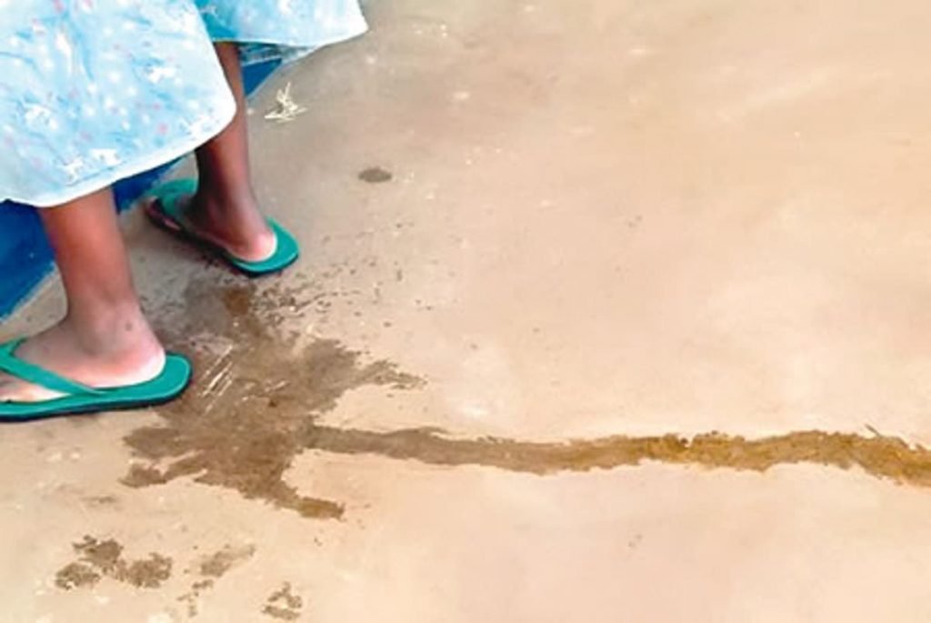 VVF: 20 women benefit from free repairs in Bauchi