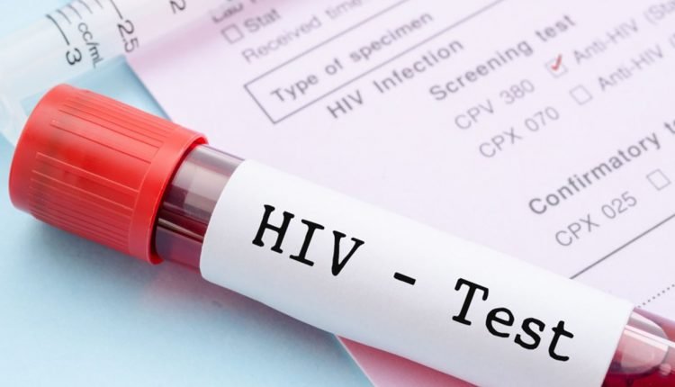 NACA says it has identified 1.7 million Nigerians living with HIV