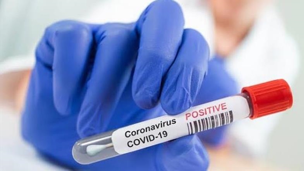 Nigeria records 1,547 COVID-19 infections