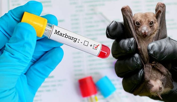 Expert urges intensified surveillance on Marburg disease, says symptoms similar to malaria, typhoid fever
