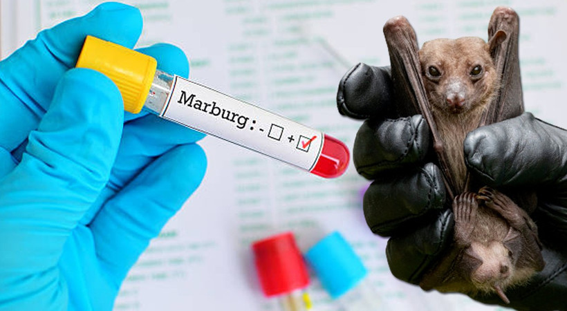 Expert urges intensified surveillance on Marburg disease, says symptoms similar to malaria, typhoid fever