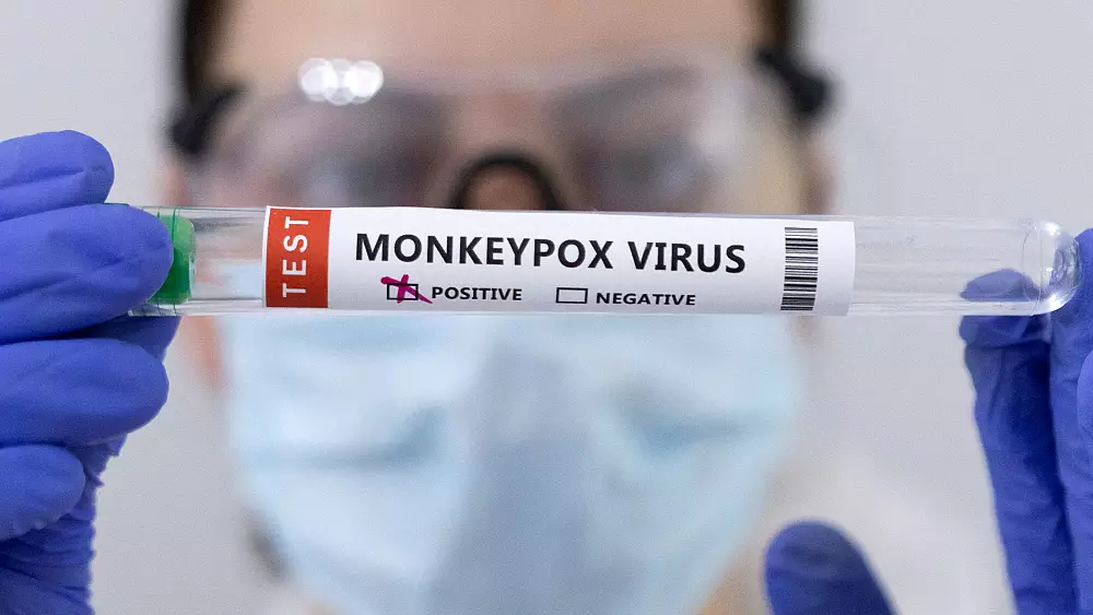 Monkeypox cases top 35,000 in 92 countries -WHO