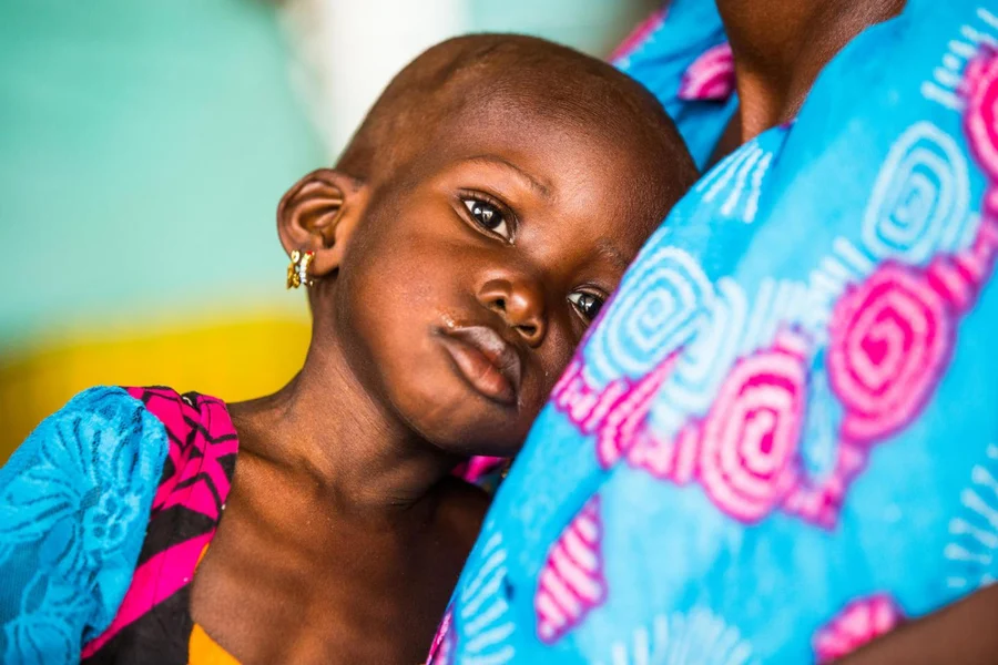 Malnutrition: UNICEF to train Adamawa health workers