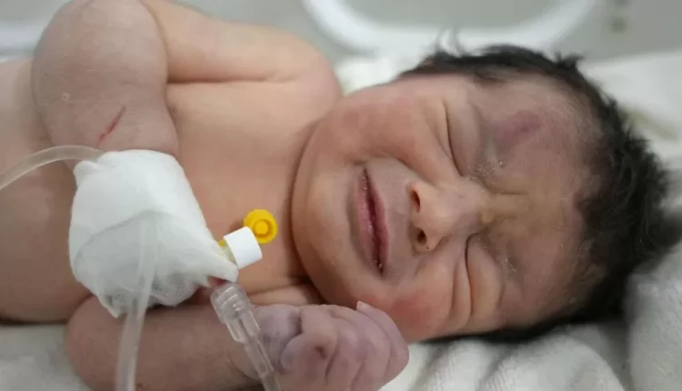 ‘Miracle baby’ still being cared for in hospital in northern Syria