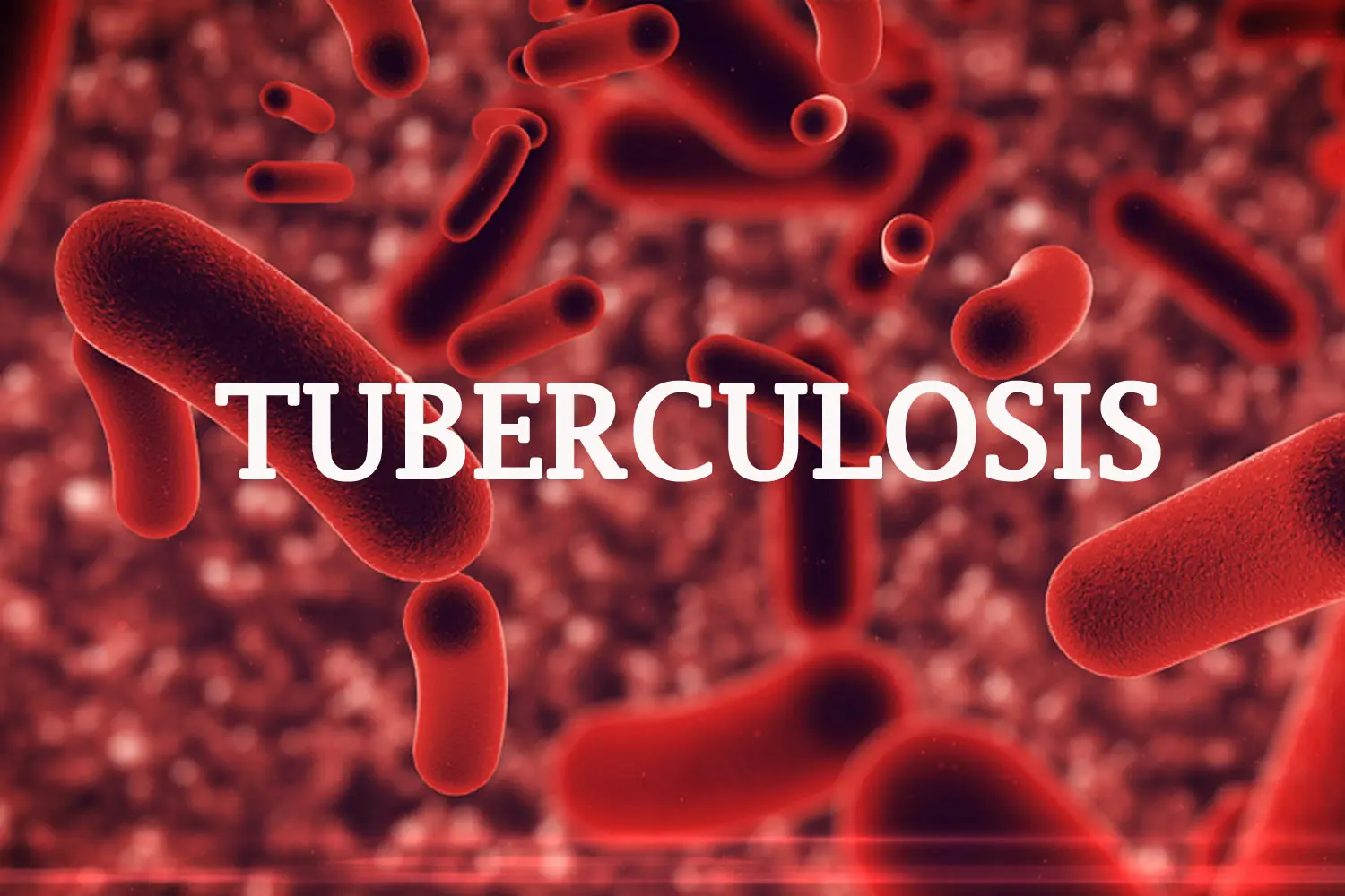 Bauchi State detects 7,806 cases of tuberculosis