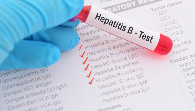 Hepatitis B is 100 times more infectious than HIV, Expert warns