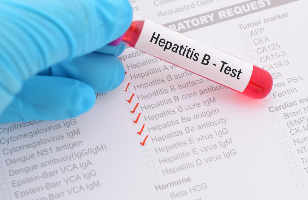 Hepatitis B is 100 times more infectious than HIV, Expert warns