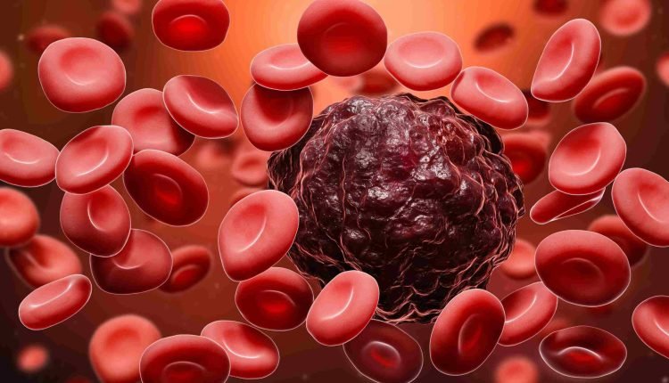 Association seeks improved healthcare systems  for cancer treatment