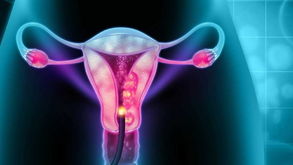Cervical Cancer: Oncologist advises yearly screening