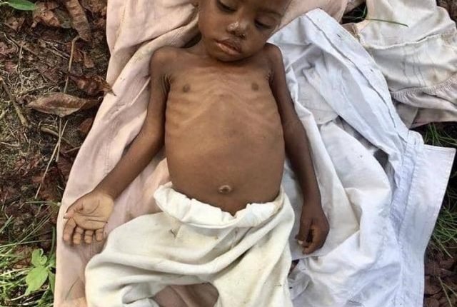 1-year-old girl accused of witchcraft abandoned in bush rescued