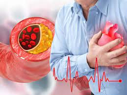 Stroke Prevention Tips: Top 7 Ayurvedic Drinks To Improve Blood Circulation In Heart Arteries Naturally