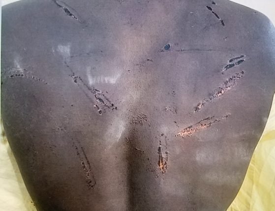 Man petitions Bauchi CP over alleged brutality by police officer