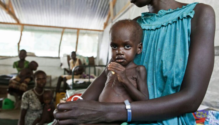 FG reaffirms commitment to combating malnutrition nationwide