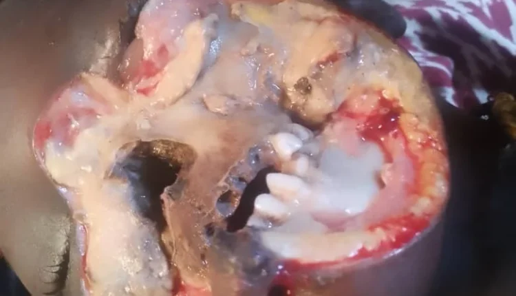 Adamawa community laments outbreak of strange ailment