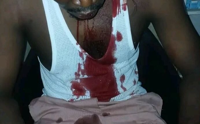 Kaduna APC condemns violence against members, demands police probe