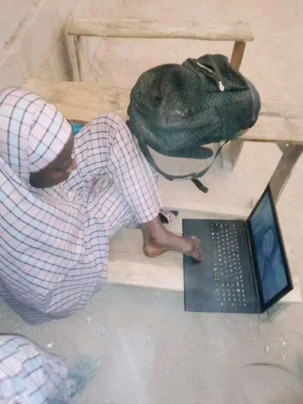 ASUU sponsored my university education – Gombe limb difference student